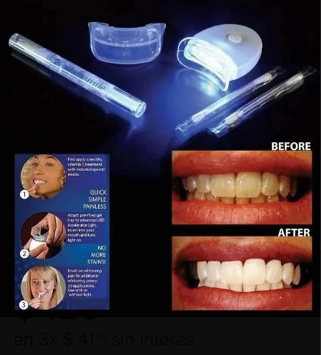 Blanqueador Dental 20 Minutos Ultravioleta