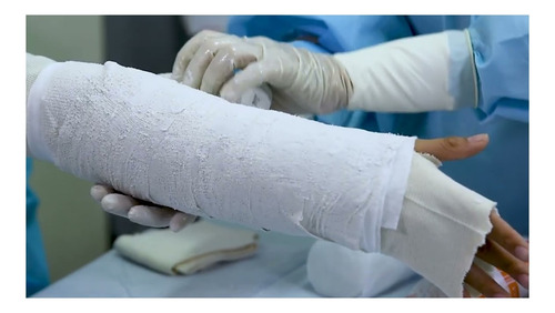 Venda De Yeso 7.5cmx 3m Yesoterapia Lesiones Moldes - 1 Unid