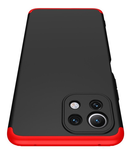 Carcasa Para Xiaomi Mi 11 Lite 360° Marca - Gkk