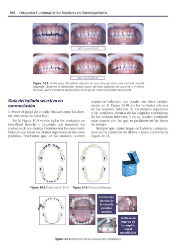 Ortopedia Funcional De Los Maxilares En Odontopediatría. Incluye E-book: Rehabilitación Neuroclusal Precoz, De Margarita Ponce Palomares. Editorial Amolca, Tapa Dura, Edición 1 En Español, 2024