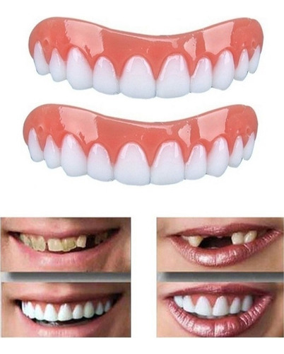 2 Set De Prótesis Profesionales De Silicona Brillante Dentes