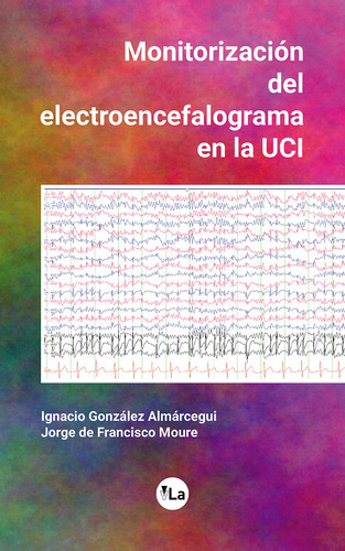 Monitorizacion Del Electroencefalograma En La Uci