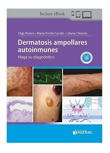 Dermatosis Ampollares Autoinmunes: Haga Su Diagnóstico Nuevo