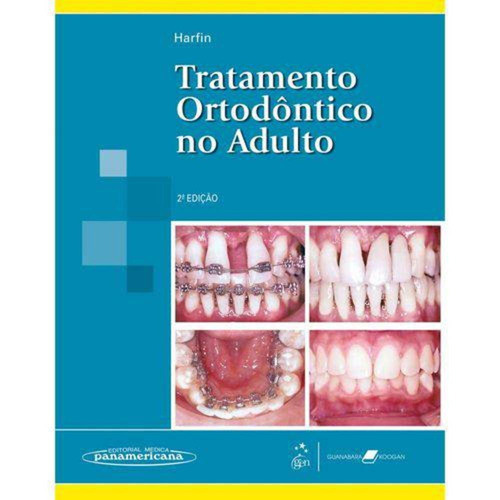 Tratamento Ortodôntico No Adulto  2ª Edição