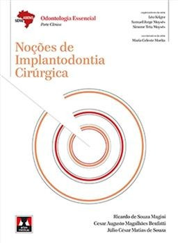 Noções De Implantodontia Cirúrgica