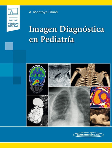 Imagen Diag. En Pediatría. Montoya Filardi. Panamericana