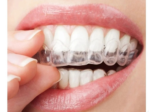 Par Protectores Bucales Dental Guardas/blanquea/antironquido