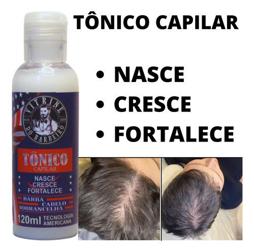 Tônico Capilar Para Fortalecimento De Cabelo Fino E Frágil!!