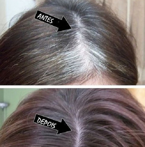 Shampoo Tônico Escurece Grisalho/branco Cabelo Unissex - *