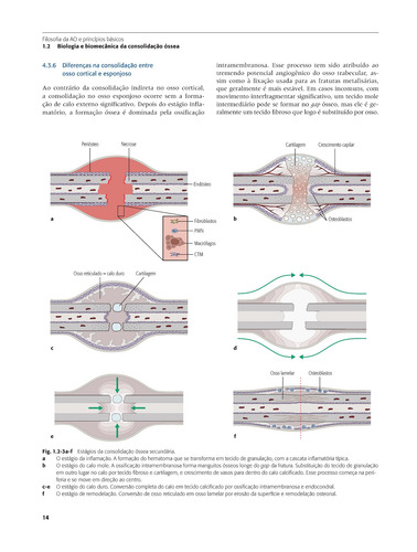 Princípios AO do Tratamento de Fraturas - 2 Volumes, de Buckley, Richard E.. Editorial ARTMED EDITORA LTDA.,Thieme Medical Publishers Inc., New York, capa dura em português, 2020