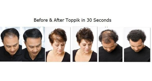 Imagen 6 de 7 de Fibras Capilares Toppík #1 Para Caída Del Cabello Americano