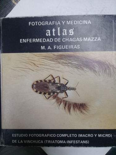 Fotografia Y Medicina Atlas Enfermedad De Chagas Mazza. Es
