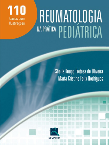 Reumatologia na Prática Pediátrica, de Knupp, Sheila. Editora Thieme Revinter Publicações Ltda, capa dura em português, 2015