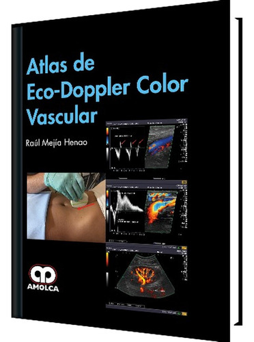 Atlas De Eco-doppler Color Vascular Mejia