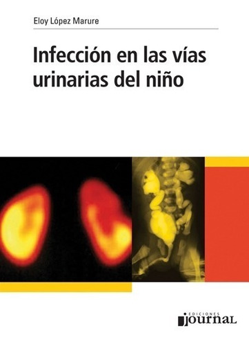 Infección en las vías urinarias del niño, de López Marure, Eloy. Editorial EDICIONES JOURNAL, tapa blanda, edición 1 en español, 2012