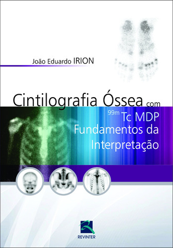 Cintilografia Óssea com 99M Tc MDP: Fundamentos da Interpretação, de Irion, João Eduardo. Editora Thieme Revinter Publicações Ltda, capa dura em português, 2016