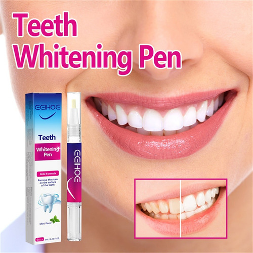 Blanqueamiento Dental E Lápiz Blanqueador Dental Blanqueamie