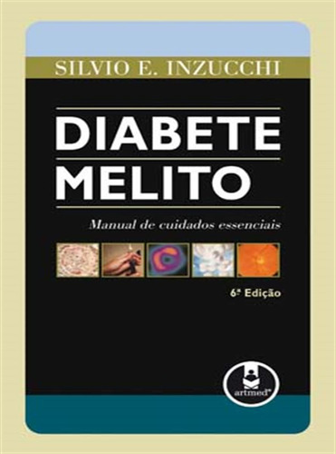 Diabete Melito