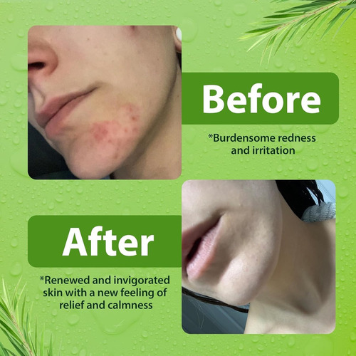 Sabonete Antibacteriano Derma-nu Com Melaleuca 12 Oz