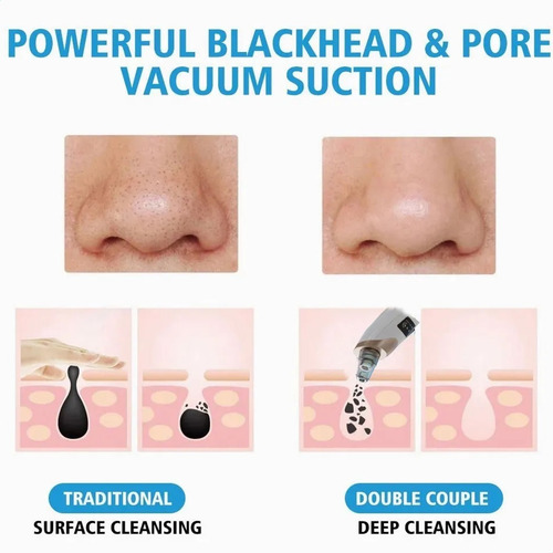 Imagen 5 de 10 de Limpiador Facial Exfoliante Removedor Poros Puntos Negros