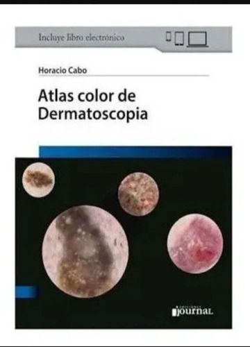 Atlas Color De Dermatoscopia Incluye Libro Electronico