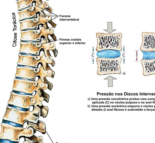Imagem 8 de 9 de 3 Posters Anatomia 65cmx100cm Muscular Esquelético Coluna