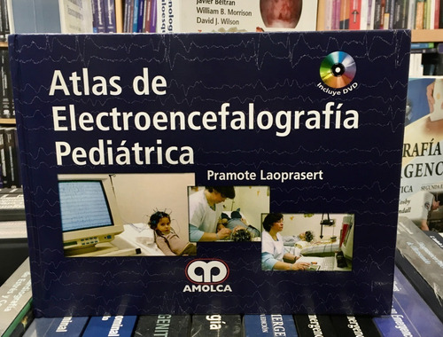 Atlas De Electroencefalografía Pediátrica