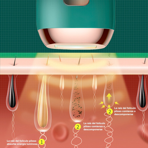 . Ipl Depiladora Láser Permanente Flashes For Cuerpo Y Cara