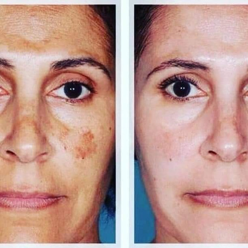 Imagen 2 de 4 de Limpiador Facial Face Wash