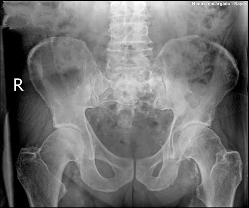 Imagen 4 de 8 de Radiografías Digitales A Domicilio Humanos Y Animales