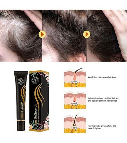 Suero Orgánico Para El Crecimiento Del Cabello Regrewth
