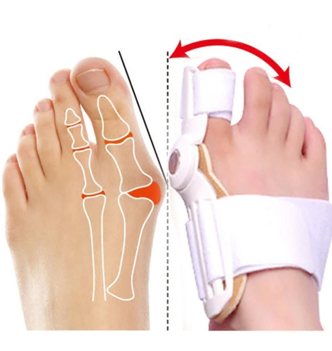 Imagen 3 de 6 de Ferula Correctora Hallux Valgus (juanete), Corrige Dedos Pie