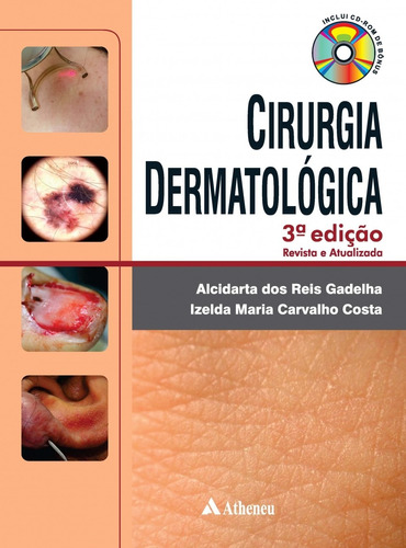 Cirurgia dermatológica, de Gadelha, Alcidarta dos Reis. Editora Atheneu Ltda, capa dura em português, 2016