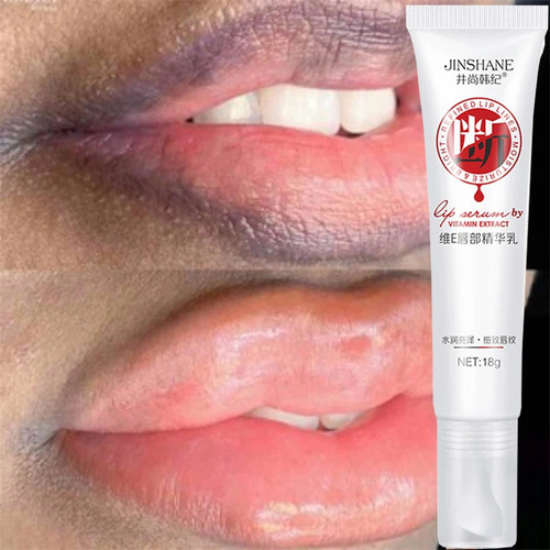 Creme Labial Rosa, Clareamento Rápido, Branqueamento, Tratam