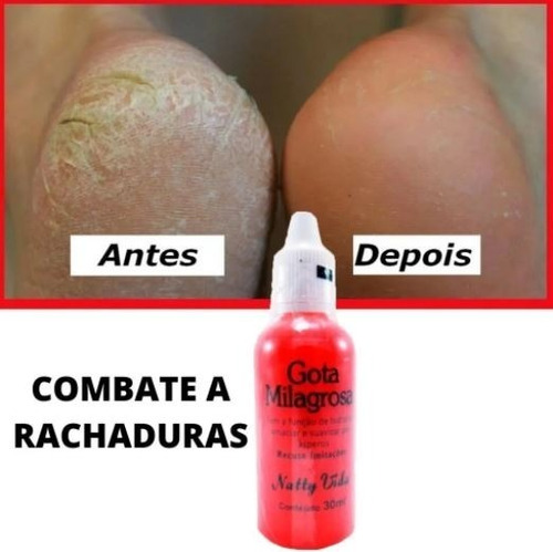 Imagem 3 de 4 de Kit 6 Gota Milagrosa Pés Combate Rachadura E Ressecamento