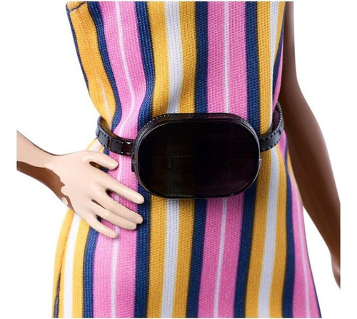 Imagem 3 de 6 de Barbie Fashionista 135 Negra Vitiligo Ms