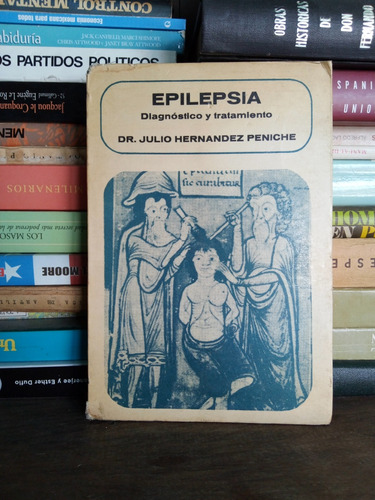 Epilepsia: Diagnóstico Y Tratamiento 