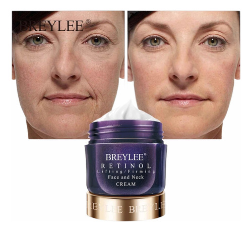 Creme Retinol Lifting Firming Face And Neck Cream Breylle Anti Envelhecimento Rugas Noite  Para Pele Normal De 40ml/40g 30+ Anos