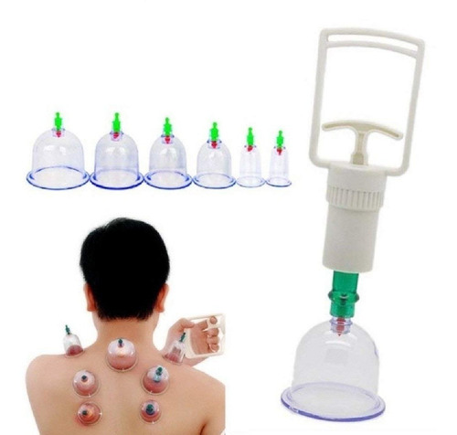 Kit Ventosas Com Bomba Terapia 6 Copos Massoterapia Estetica