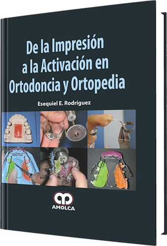 De La Impresión A La Activación En Ortodoncia Rodriguez