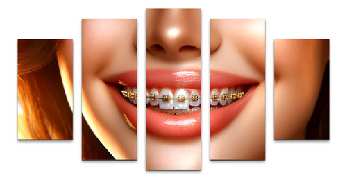 Cuadro Decorativo Para Consultorios Dentistas Braquets Salas