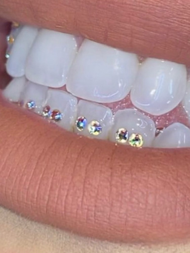 Imagen 2 de 5 de Joyas Dentales