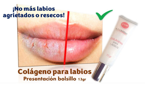 Bálsamo Colágeno Labios Agrietados Resecos 13 Grs ¡efectivo!