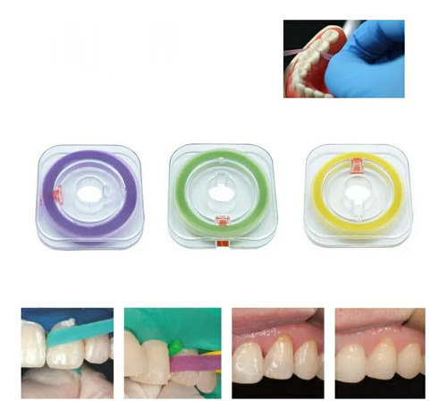 03 Rollos En Tiras Pulido Interproximal - Odontología 