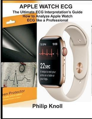 Apple Watch Ecg : The Ultimate Ecg Interpretation Guide; ...