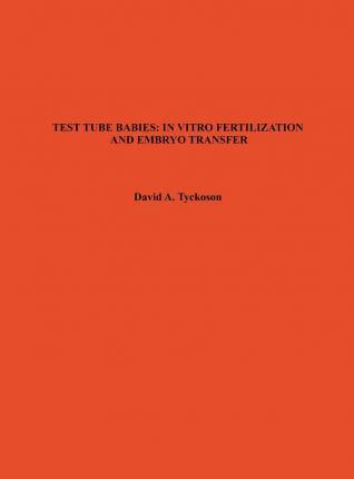 Libro Test Tube Babies: In Vitro Fertilization And Embryo...