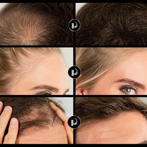 2pz Capelli® 21gr Microfibra Capilar Calvicie Caida Cabello Castaño Claro