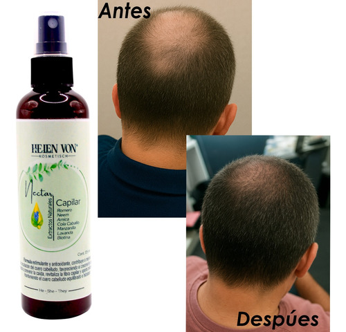 Kit Shampoo Y Nectar Fortalecedor Para Cabello Romero Jengib