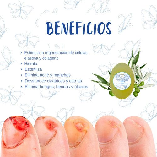 Jabón Con Aceite Ozonizado Organico Regenera Paño Manchas