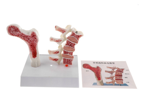 1: 1 Tamaño Natural Modelo Anatómico De Patología De